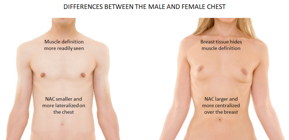 Female to Male Top Surgery case #4881